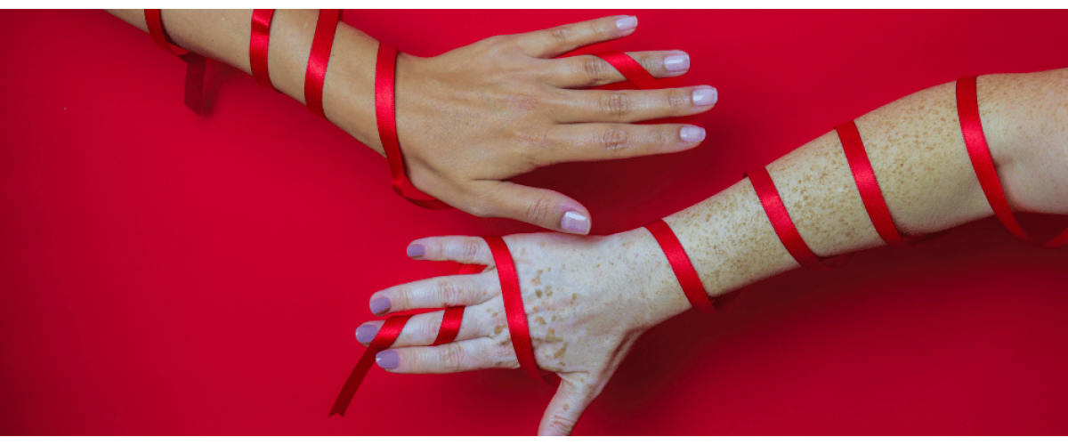 What is the Difference Between HIV, STD, and AIDS?