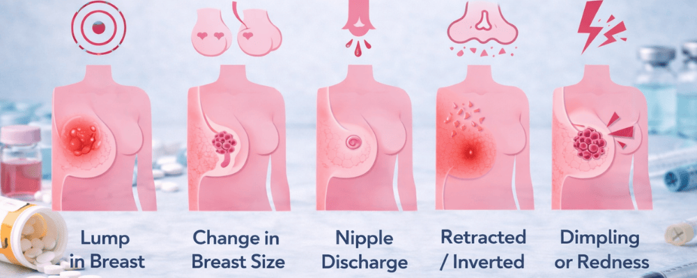 Symptoms of Breast Cancer
