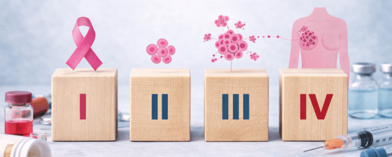 Breast cancer stages