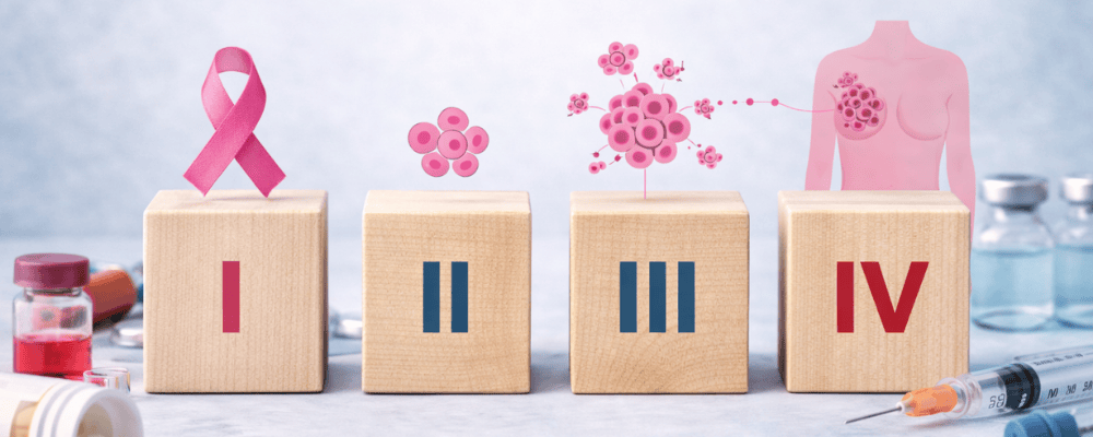 Breast cancer stages